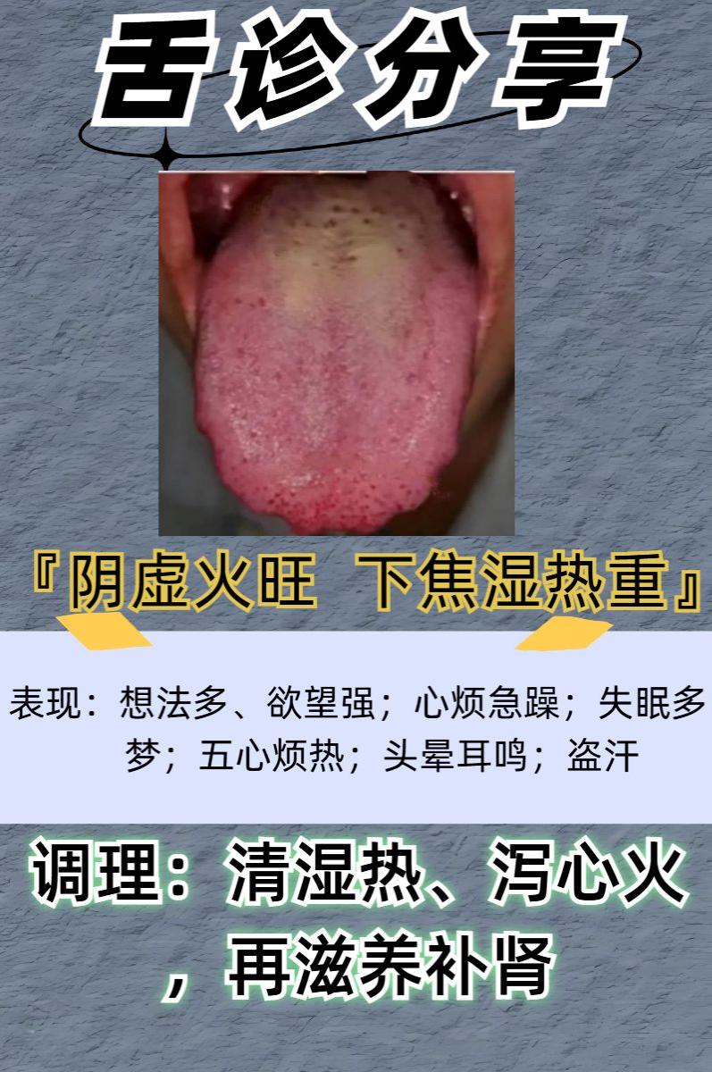 实战舌诊——今日看完88个舌象！

前段时间帮许多粉丝辨证了舌象，今天继续！
