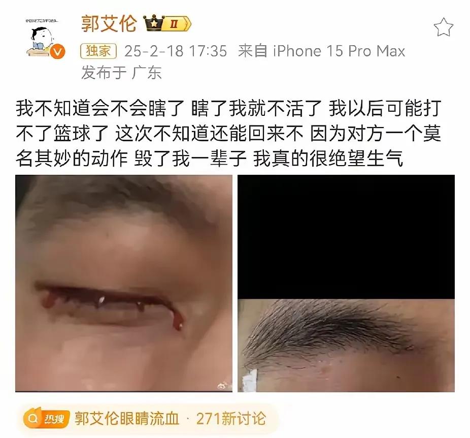 郭艾伦右眼伤情究竟有多严重，是否会影响他的职业生涯？              