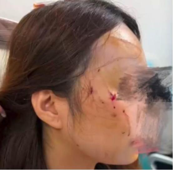 太吓人了！北京，女子被自家养了2年的宠物猫疯狂攻击，原因竟然是她把一只陌生小猫带