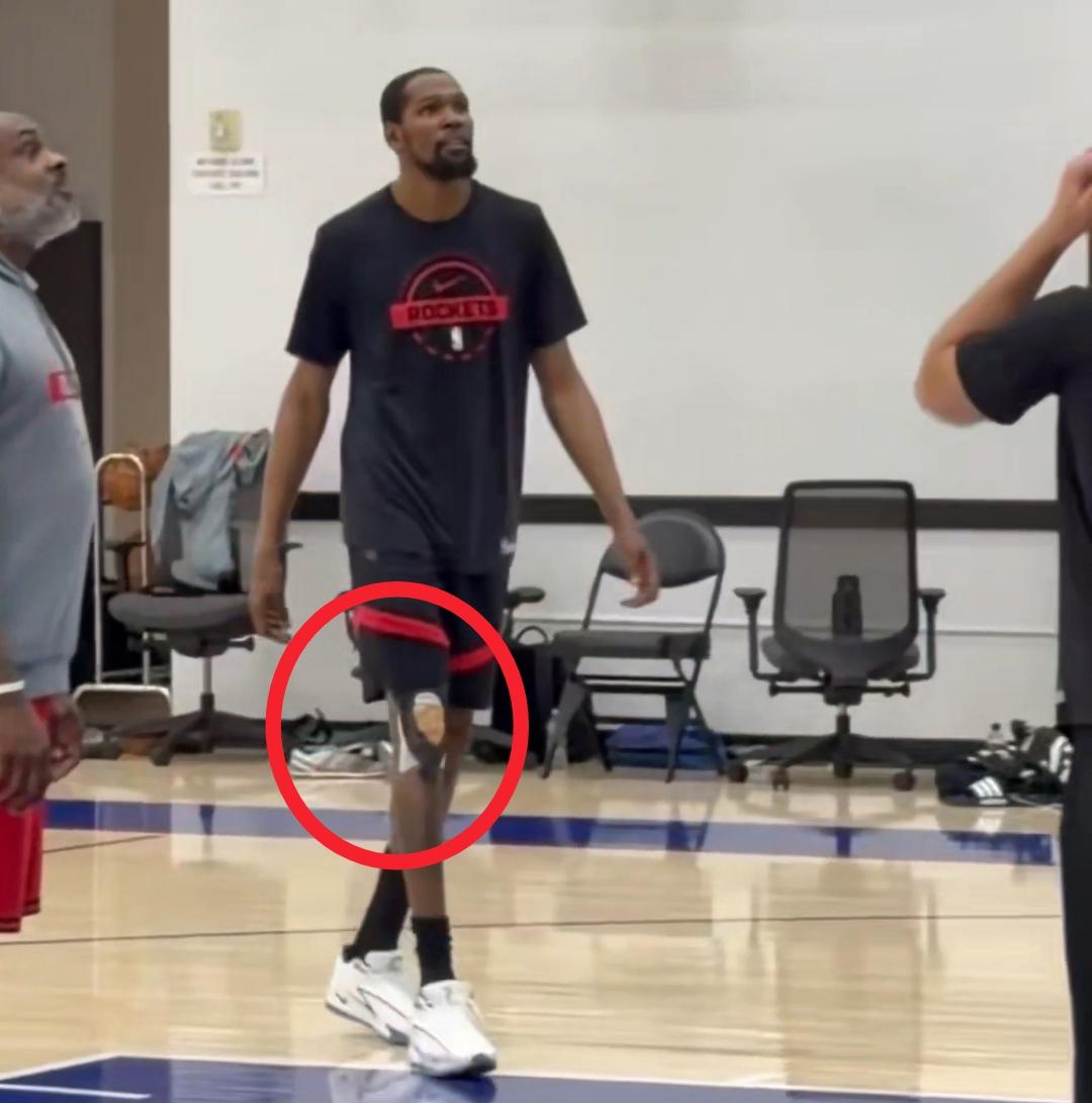 杜兰特这膝盖看起来情况不容乐观啊！做动作还是僵硬，这样的情况，如果勉强复出打G2