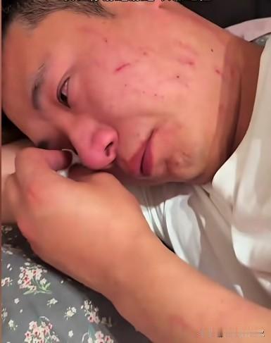 丈夫手机屏幕碎裂，喝醉进门。妻子怨气爆发，尖叫着在他脸上抓出血痕。
一场发泄后，
