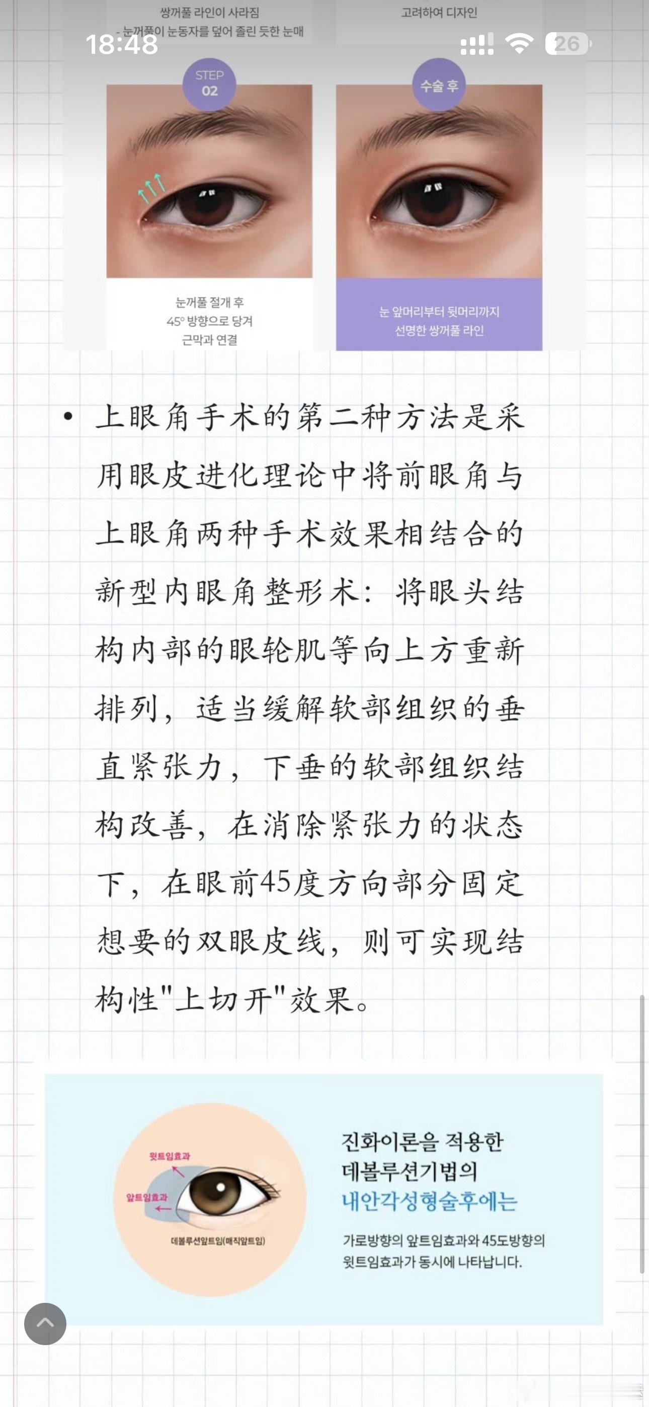 各国做上眼角的做法：🇰🇷韩国：1️⃣切开眼头45度角的表层皮肤，把被蒙古褶盖