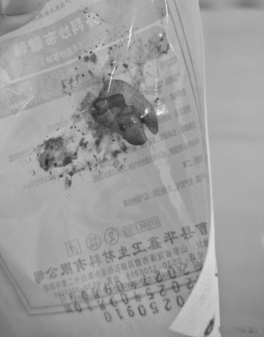 下午去拔智齿，现在麻药劲儿过了，疼的张不开嘴；本来没事结果刚人脸认证需要张嘴尬住