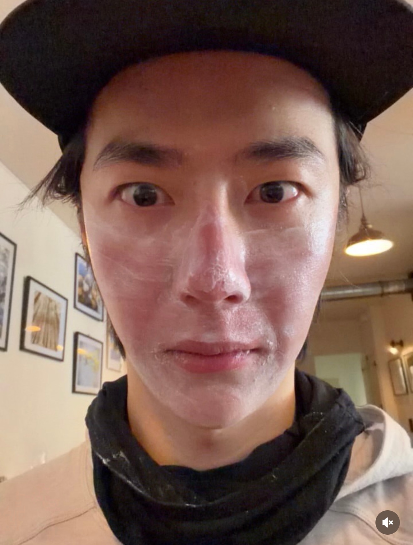 王一博的脸晒伤了宝宝好可爱 晒后修复一下 ​​​