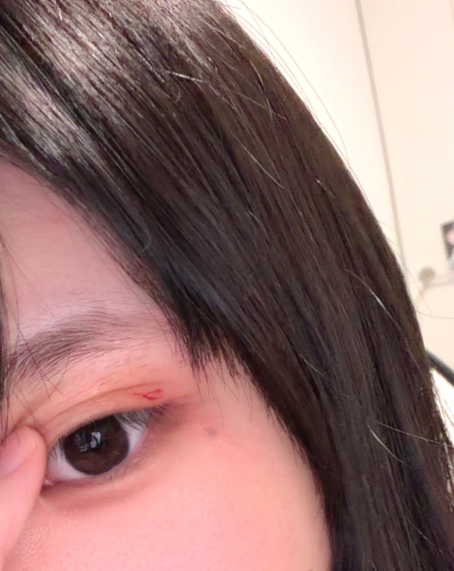 我他妈被猫打了呀 
