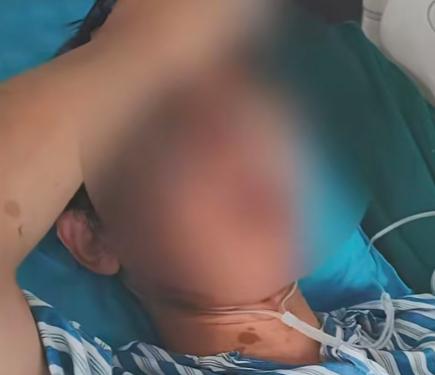 年仅 18 岁，本该是身体扛造、活力满满的年纪，长沙一名男生却差点因为长期熬夜丢