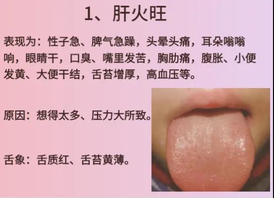 上火可以这样来补
很多朋友吃点辣的就上火，吃点补的也上火，那么怎么补才能不上火呢