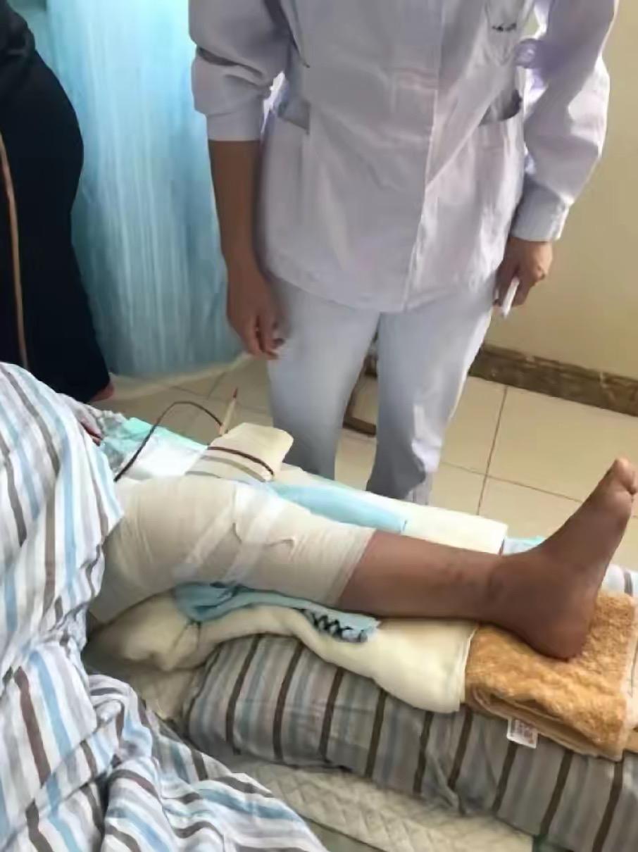 四姨摔了一跤小腿骨折需要手术，两个女儿，一个儿子，没一个人拿钱，四姨有点钱也就五