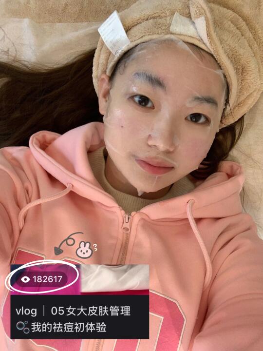 05女大｜18万人看过的祛痘体验！修复过程来啦