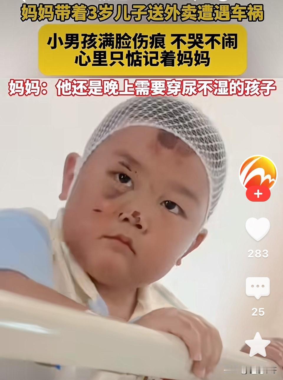 懂事的让人心酸！浙江衢州，单亲妈妈带着3岁儿子送外卖，途中遭遇车祸，妈妈浑身多处