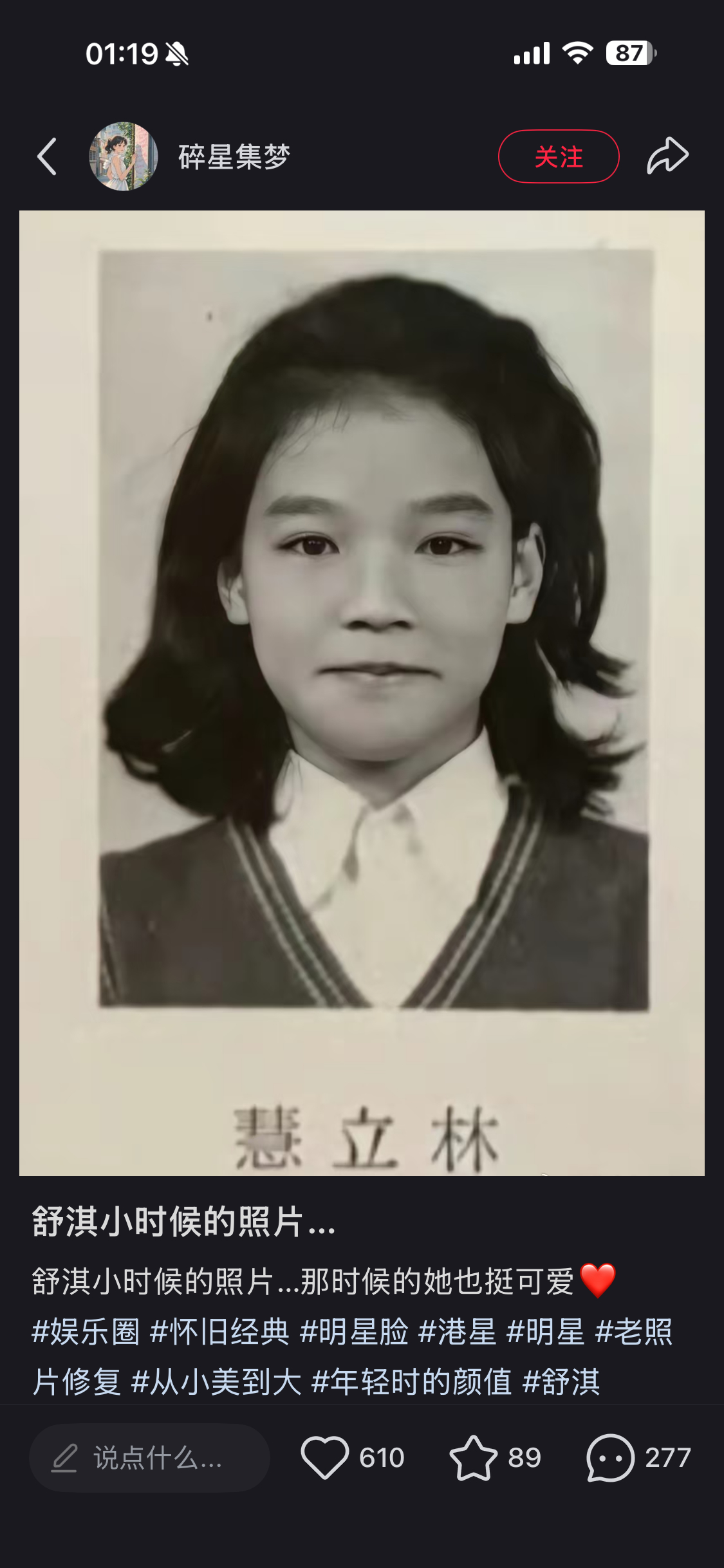 小时候也不难看，但现在是顶美级别的，最重要她没整容。 