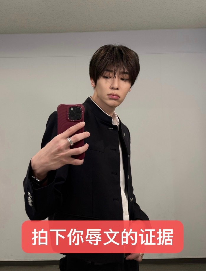 MVP结算 ​​​