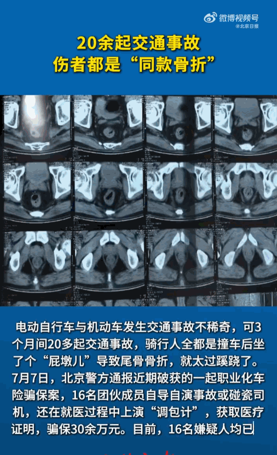 胆子真大！北京，短短3个月里，竟然接连发生了20多起离奇的交通事故。说它离奇，是