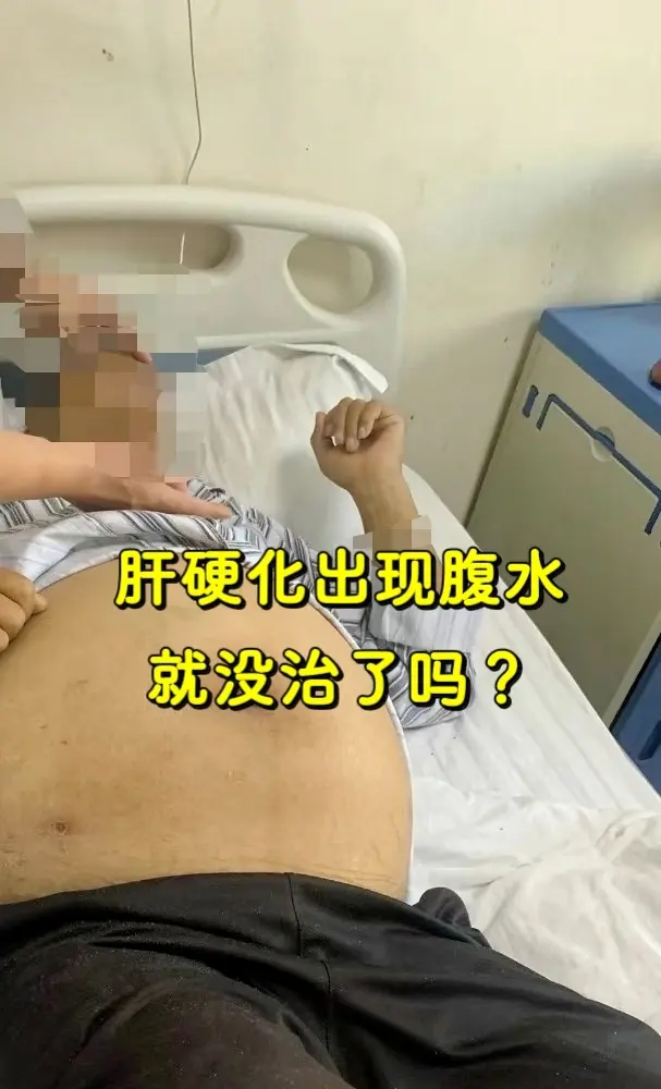 肝硬化出现腹水就没治了吗？本来确诊为，就已经给患者包括家属带来很大的心...