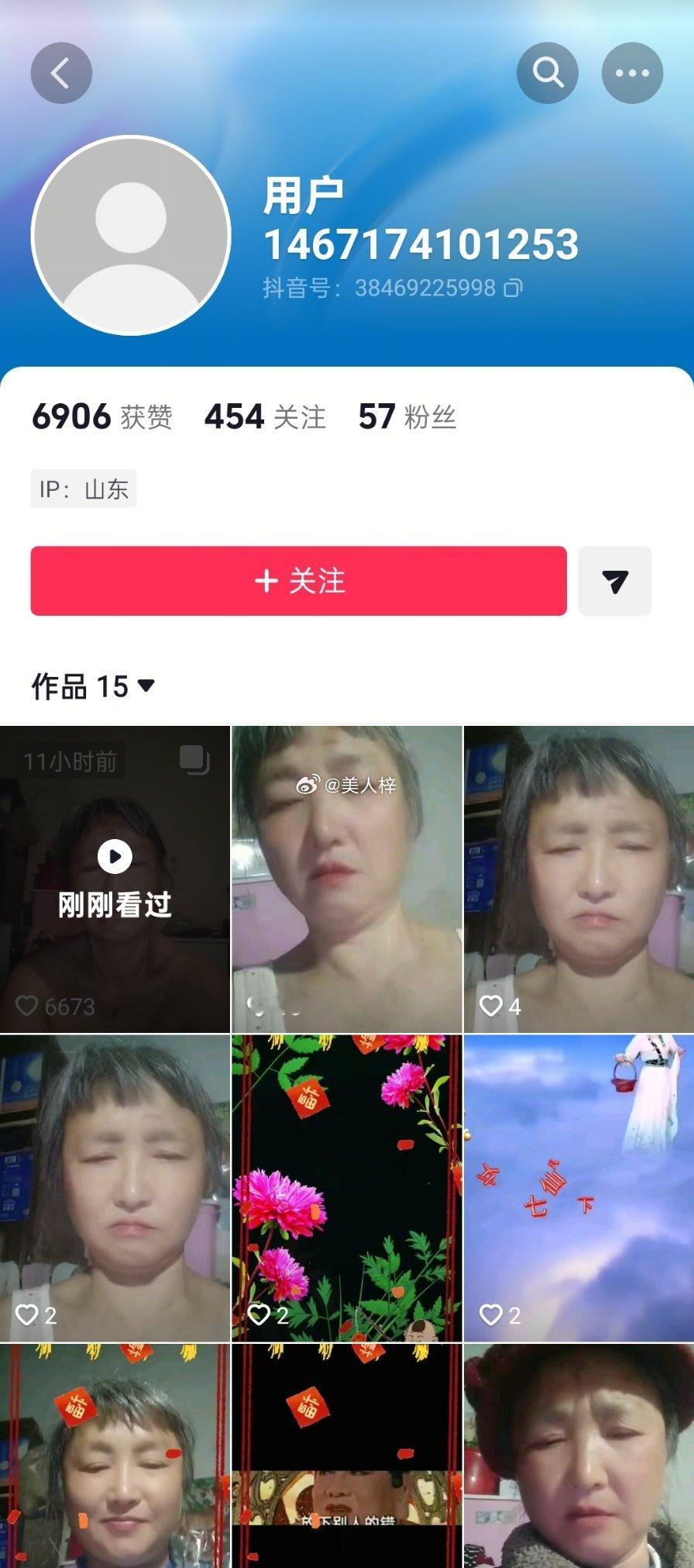 这是这位阿姨的抖，这是她最新的视频，没有文案，但是伤口很明显，我不知道她发生了什