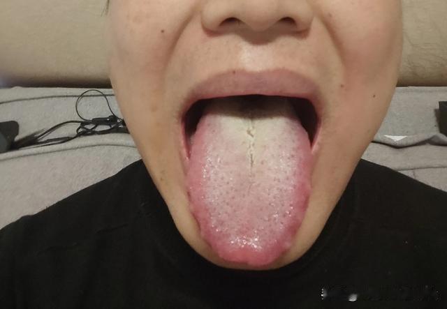 门诊小伙，才刚24，上来就问我怎么调理[吃瓜群众][吃瓜群众][吃瓜群众]
说自