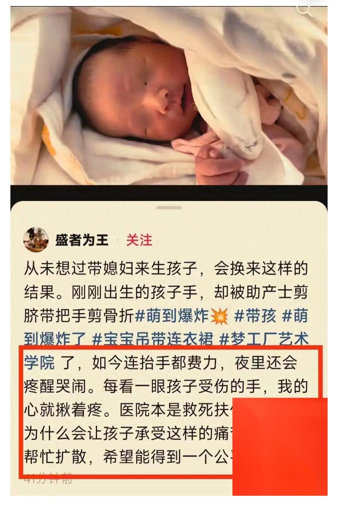 太离谱，手指被当脐带剪断！
新生儿脸涨红哭得撕心裂肺，好心疼 ……

2025年