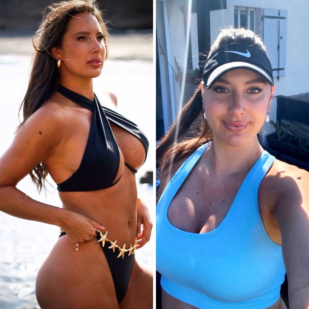 前TOP50多丁宣布因内耳问题休战近一年后即将重返网坛，休赛期间多丁进行了隆胸手