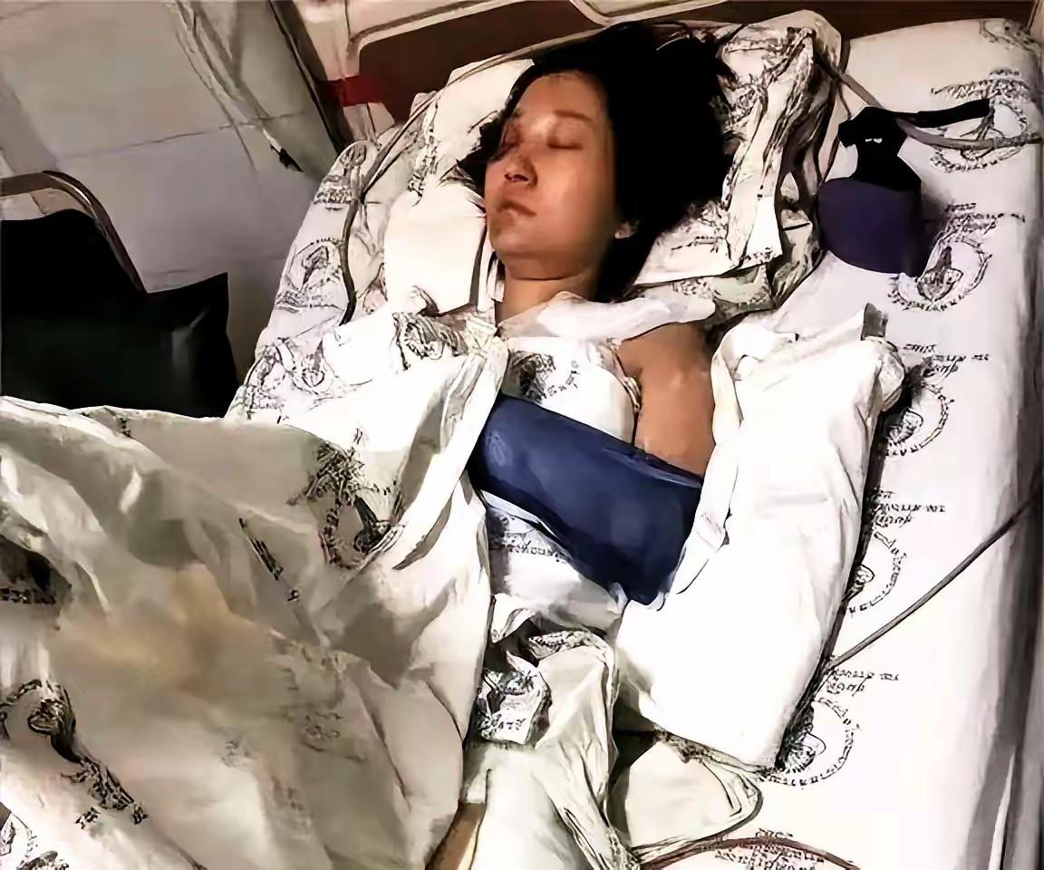 怀孕四个月的嫂子，被十九岁的小姑子一把推下楼梯，孩子没了。丈夫赶到医院，开口第一