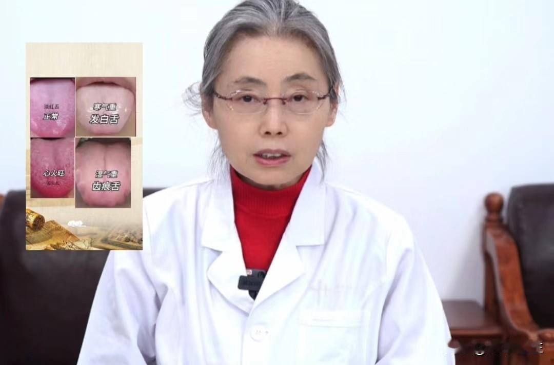 中医舌象辩证挑战，发多少我看多少，全天在线解答！