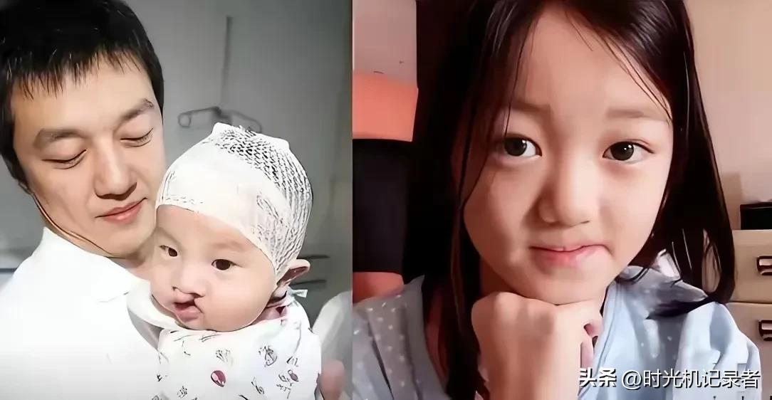 不得不佩服王菲的基因，两个女儿都很漂亮，李嫣因为从小嘴巴有兔唇，一直被保护的很好