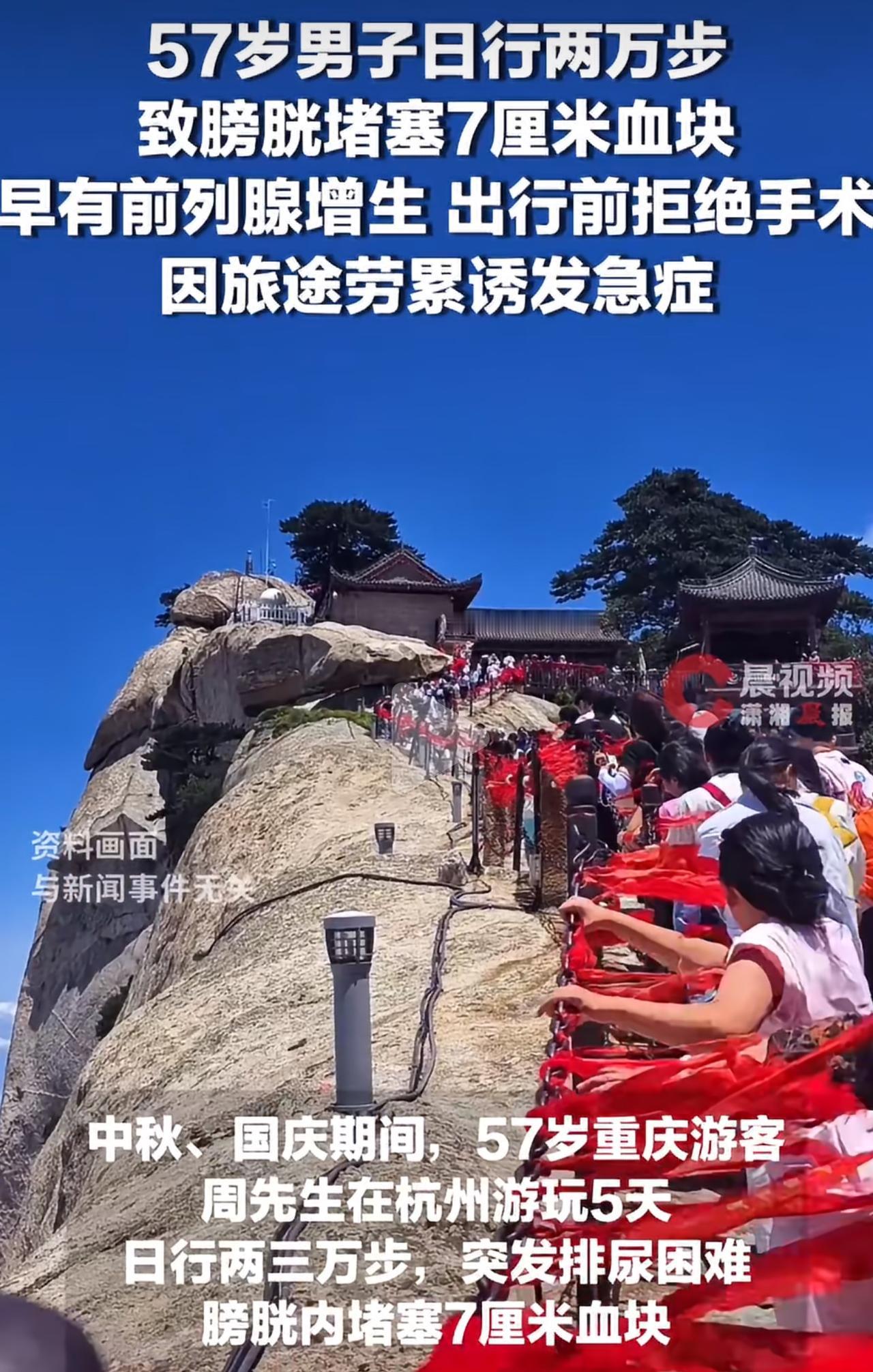 57岁的重庆周先生，本身患有严重前列腺增生，增生尺寸达到5.5厘米。出行前一周他