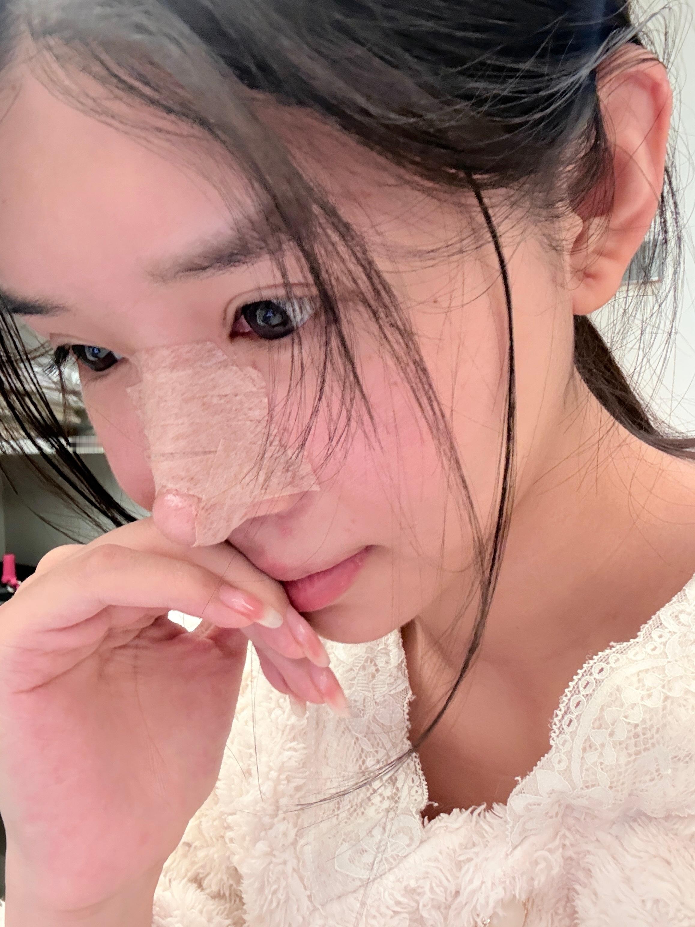 前几天的照片了 这几天皮肤过敏了 满脸起疹子呜呜呜呜呜 每天两眼一睁就得戴隐形眼