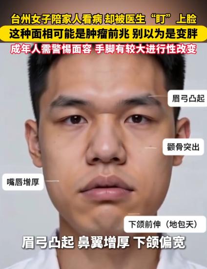 不可思议！浙江台州，一女子陪弟弟去医院看病，接诊医生偶然注意到她眉弓凸出、鼻翼增