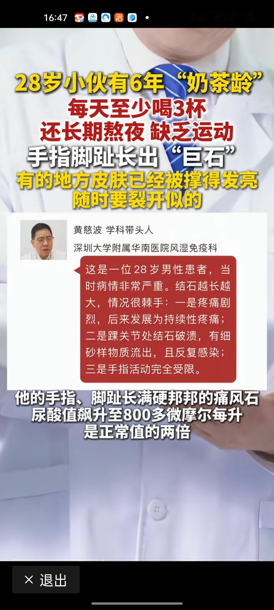 男子一天3杯奶茶手指脚趾长“巨石”：这份甜蜜，正在悄悄毁掉你的身体
 
28岁的