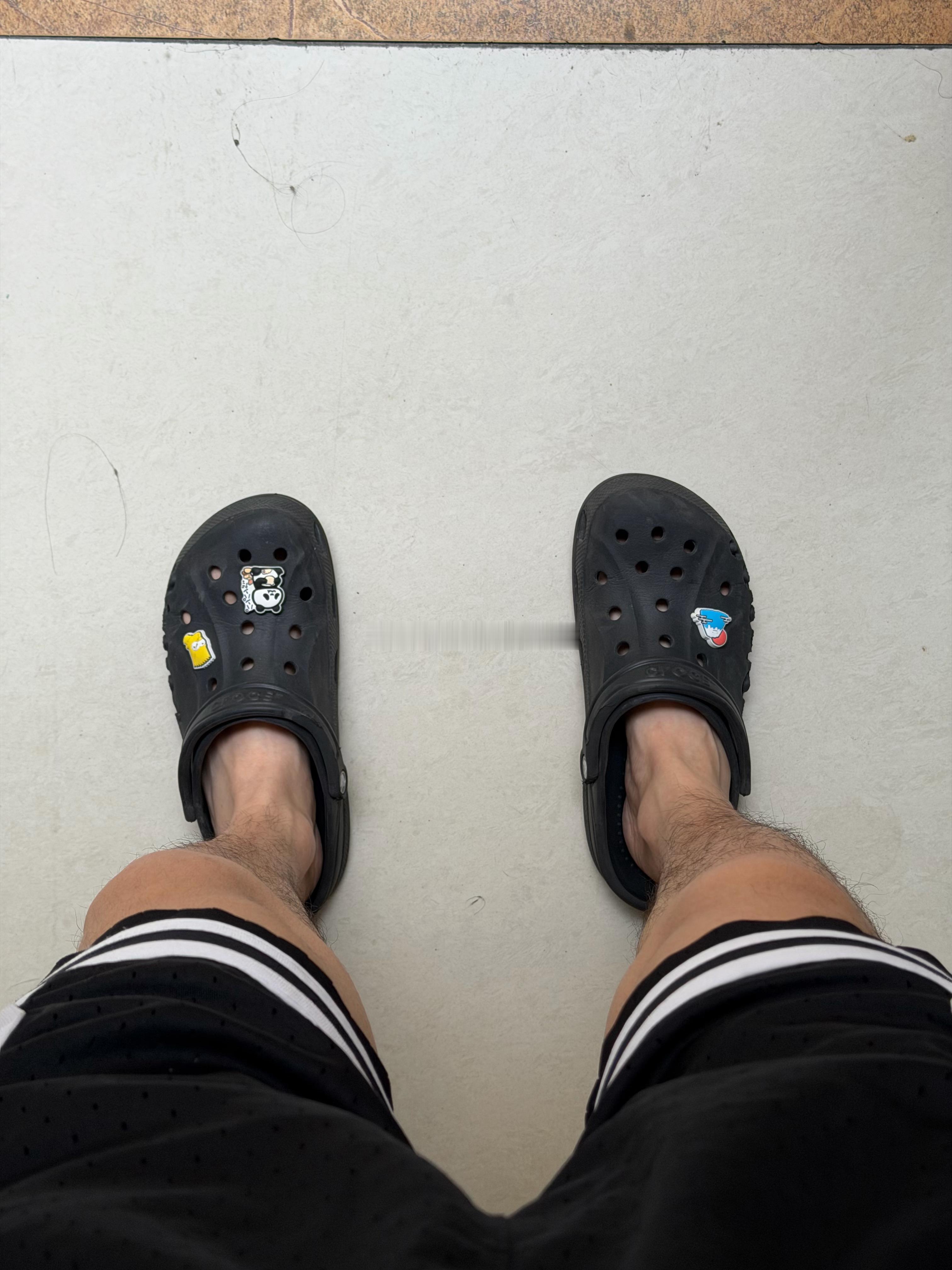 为什么小腿很多毛 大腿不长毛 