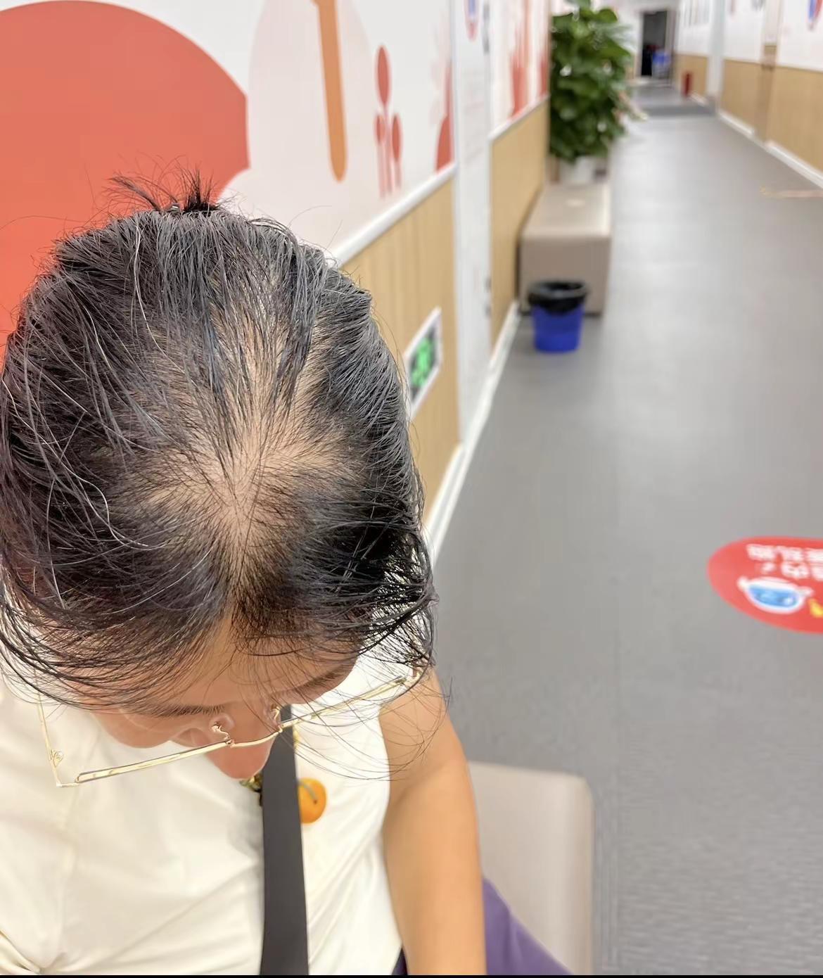 养发记录。养发记录