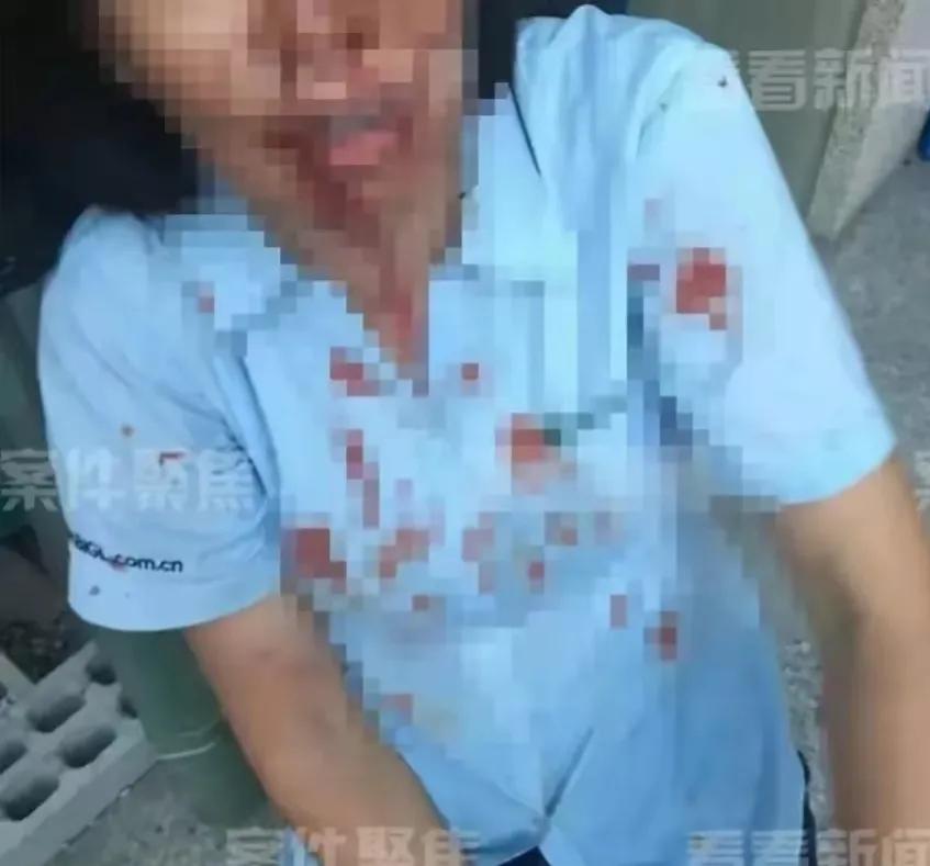 上海，兄妹俩为了争夺母亲的房产，大打出手，妹妹受伤了。外甥很愤怒，带着5人上门殴