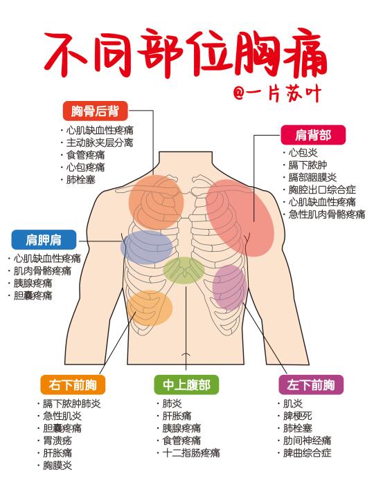 手写笔记✅一张图轻松区分“胸痛”‼