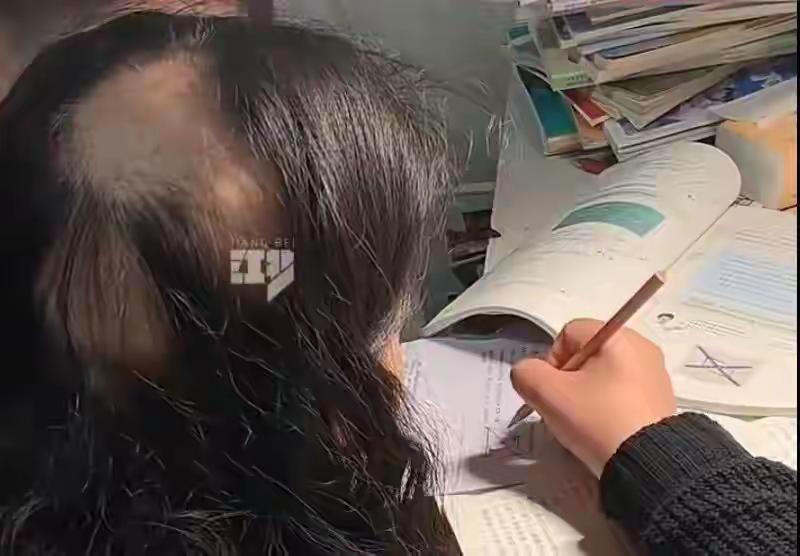 看来辅导孩子作业，那真是掉头发的事。
这在3月24日，85后的江苏宝妈，竟然发现