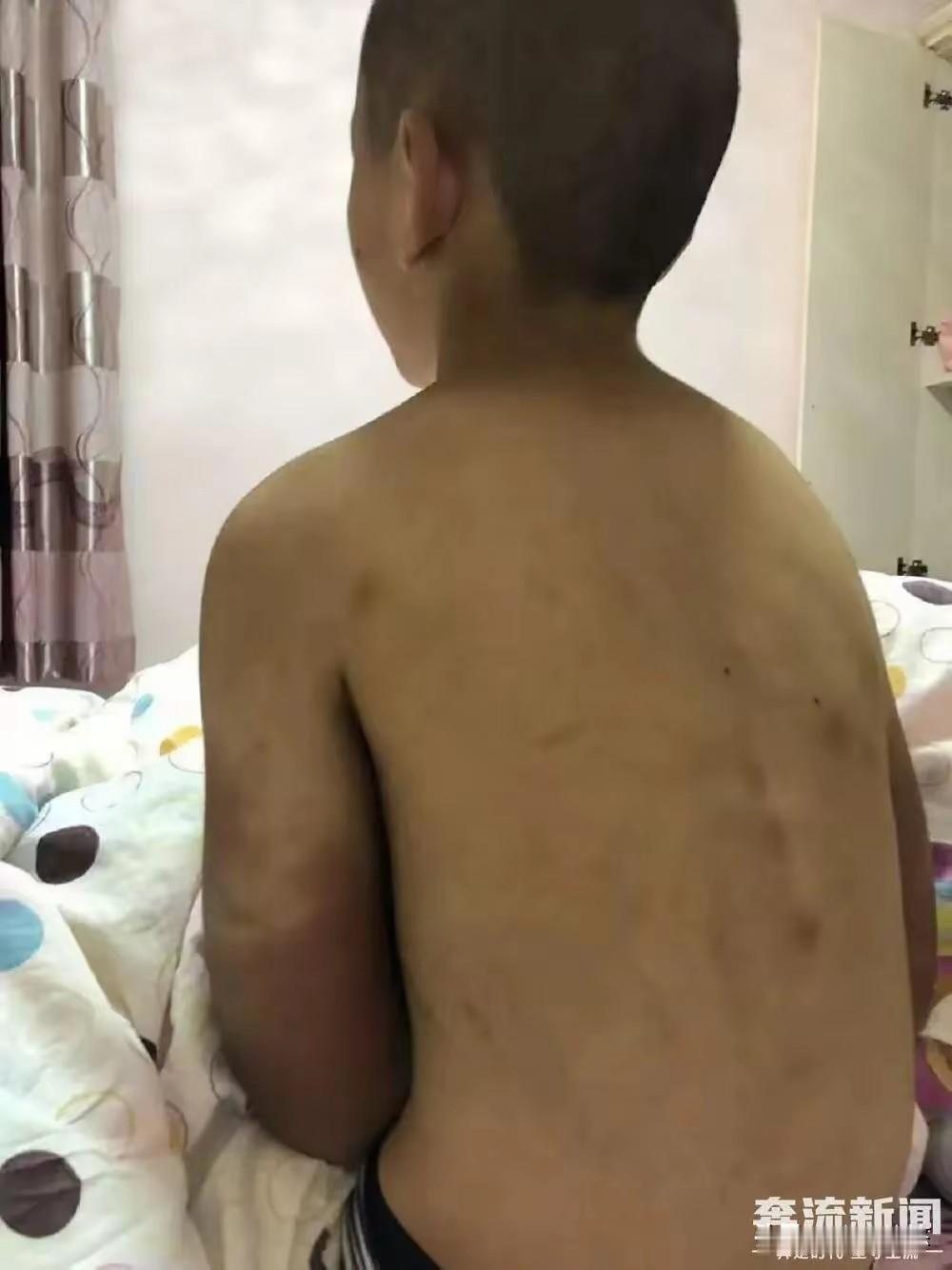 媒体报道，河南安阳市一14岁男孩遭亲生父亲和继母虐待离世。离世前没有吃饭胃里空空