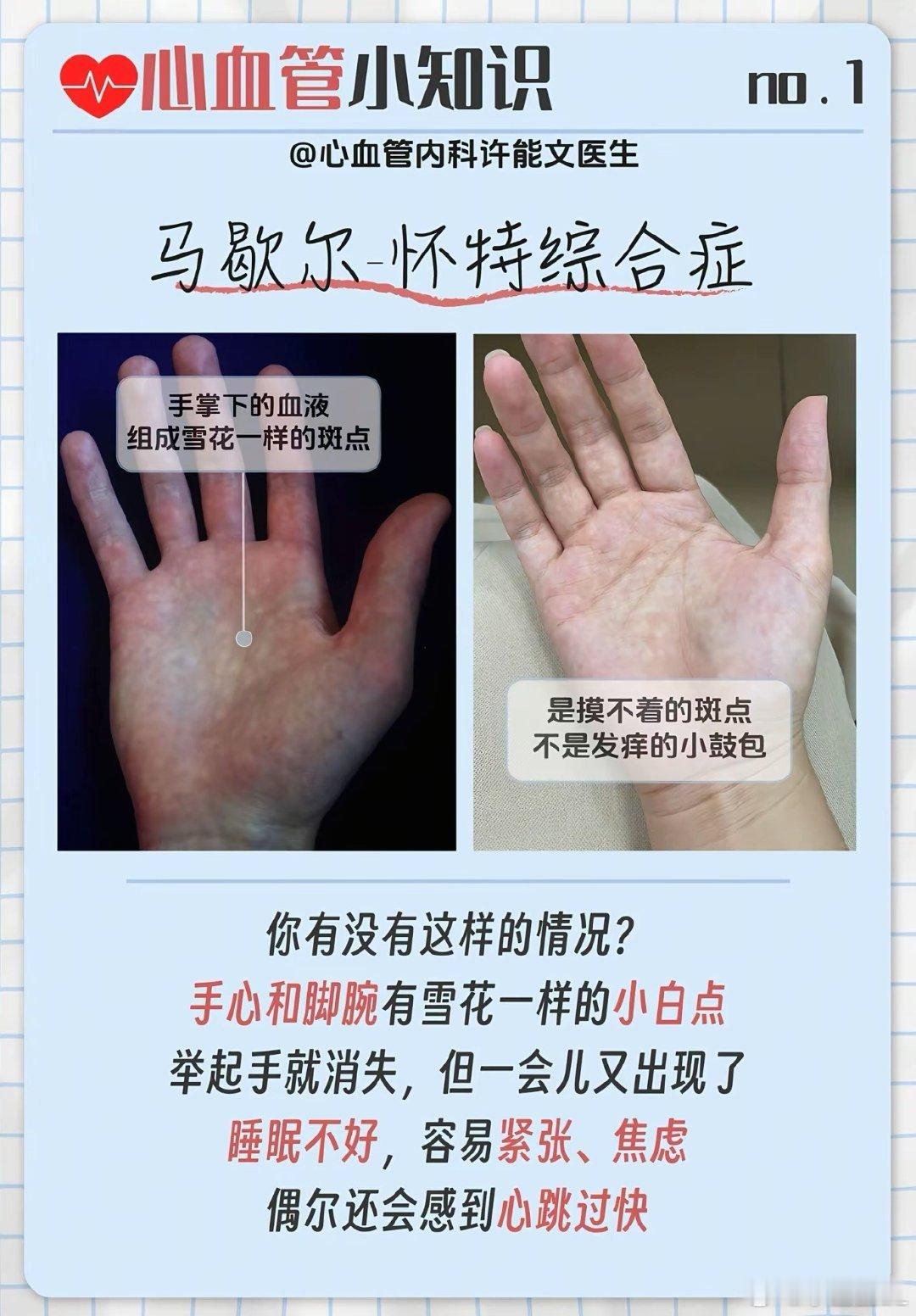 现在才知道雪花手其实是一种病看看你们有没有病？反正我没病。[允悲][允悲] ​​