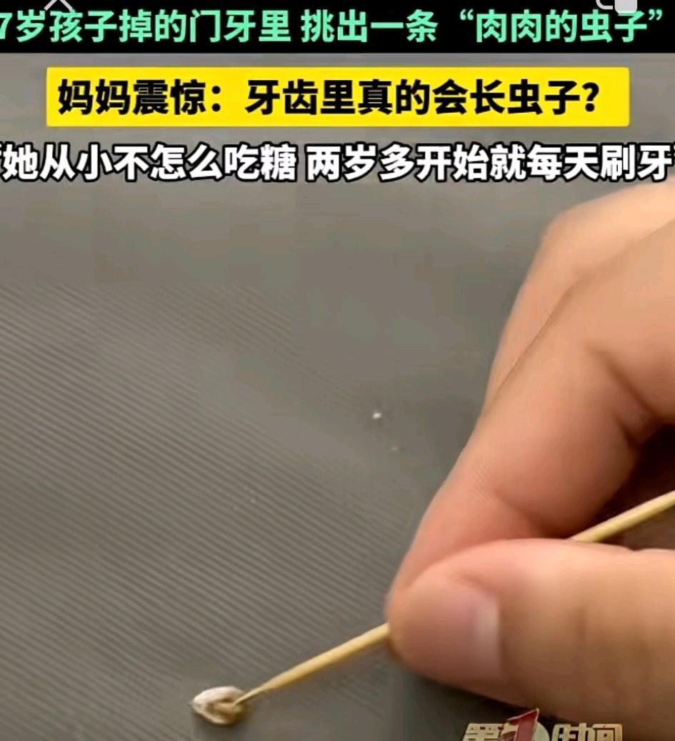 河南商丘，一妈妈发视频称，自家7岁孩子掉了一颗坏掉的门牙后，妈妈则用牙签翻看坏牙