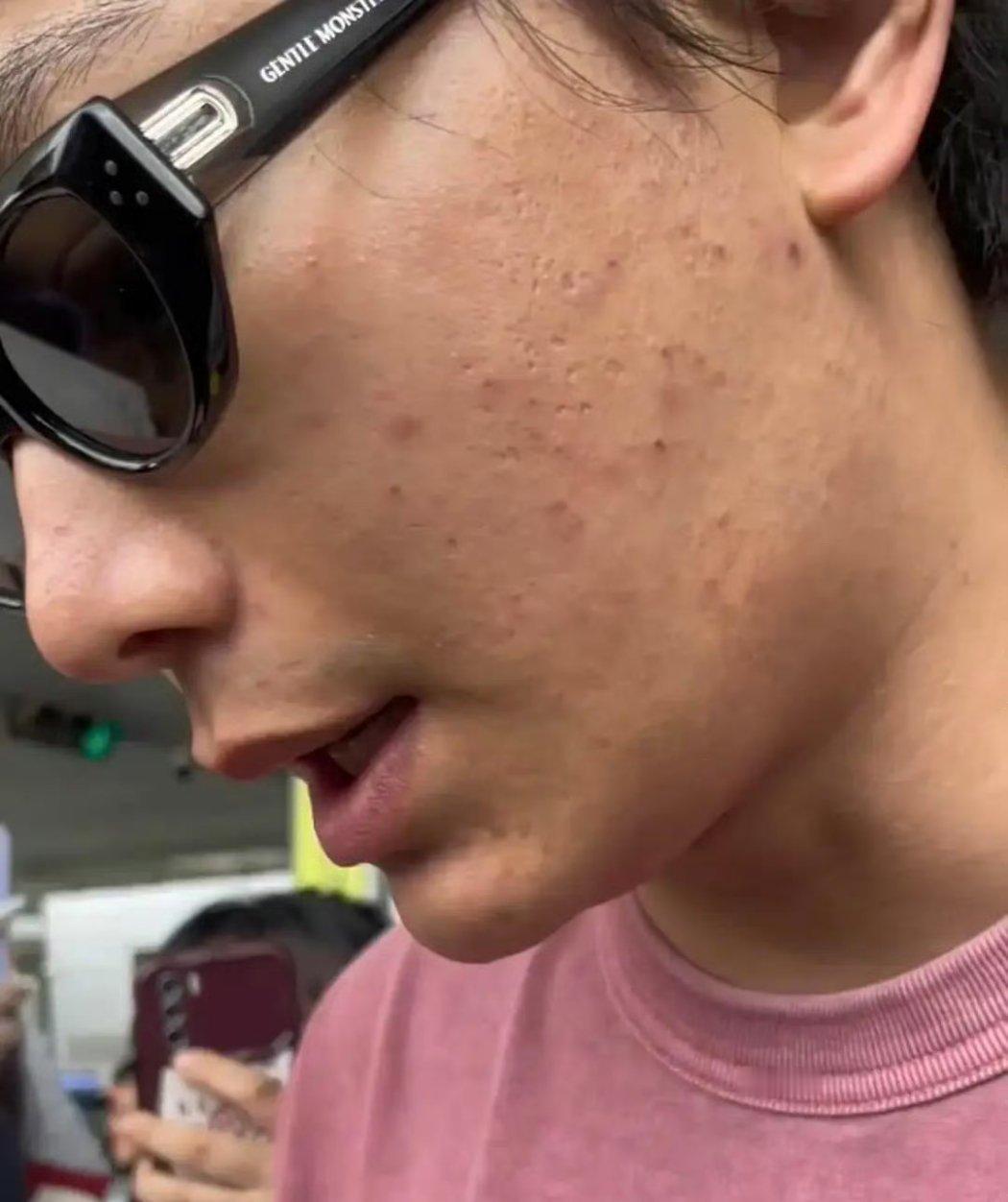 丁禹兮应该出美容书，没开玩笑 