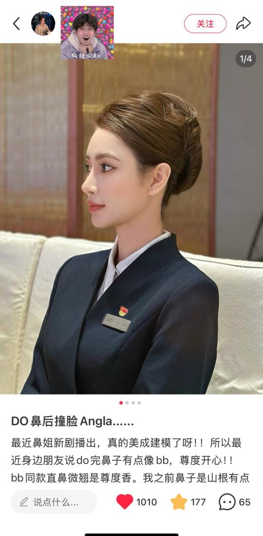 这鼻子是在上海do的？