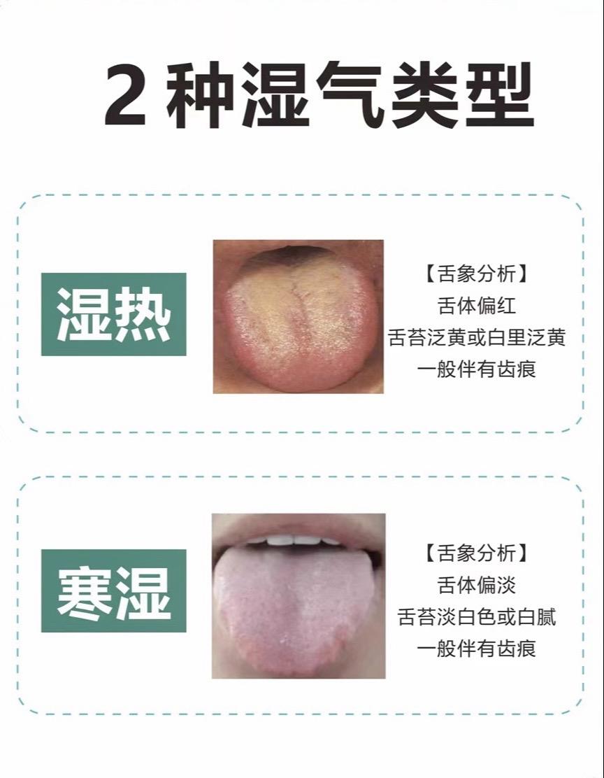 #医学科普 #舌苔辨证