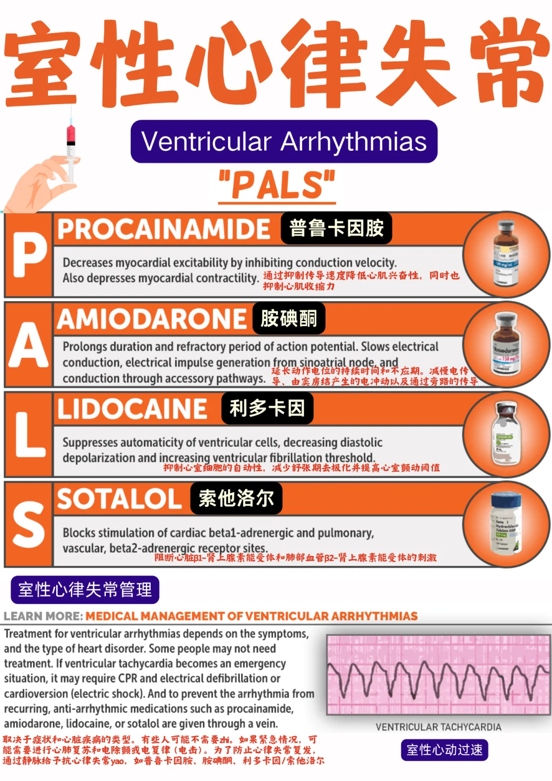 备考RN/室性心律失常！！学！！单词