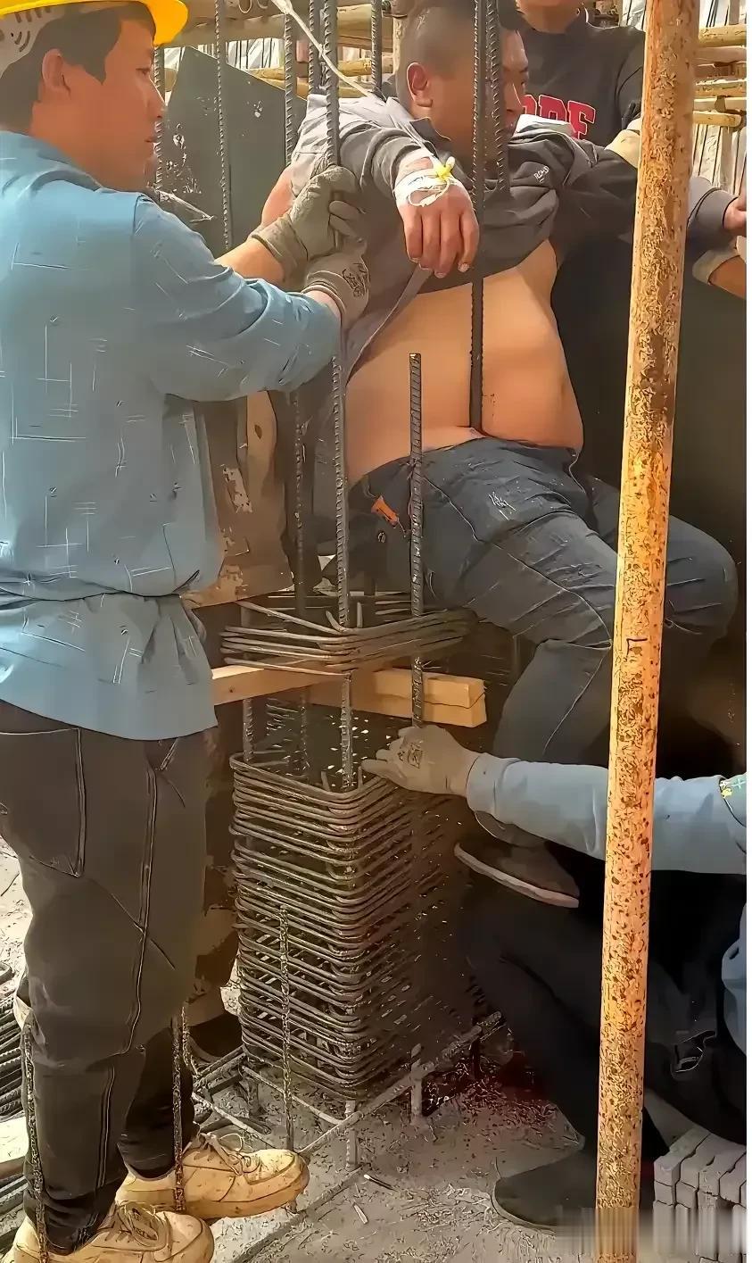 真是世间奇迹！

某工地上正在施工，一名肥胖的男子不小坠落，被五根钢筋直插身体，
