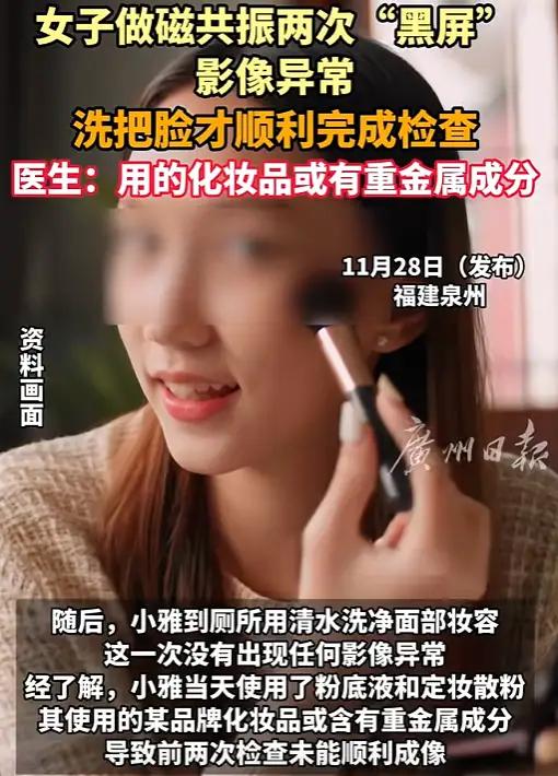 解释不清了！福建一29岁女生头晕，去医院做头颅磁共振。不料，连续2次扫描，都因面