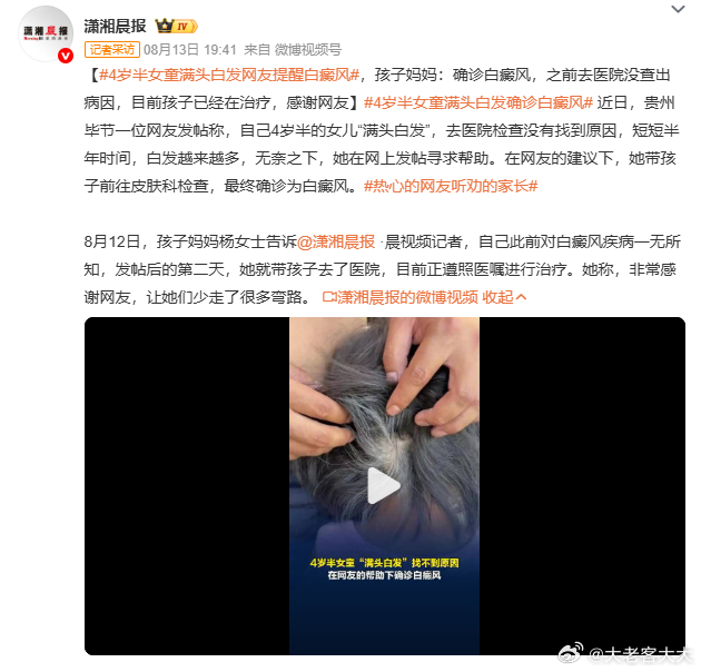 4岁半女童满头白发网友提醒白癜风这个案例最让人琢磨不透的细节在于，为什么之前去过