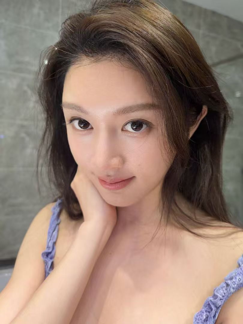 我们的植发做的蛮好的，医生也可以说是技术top5的水平，我们的价格是官方的8折，