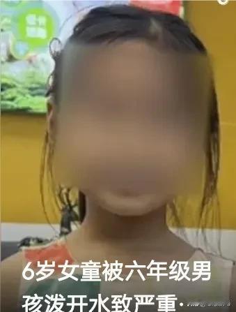 震惊全网！广东韶关校园内，竟发生一起六年级男生用开水烫伤六岁女童的严重事件，伤口