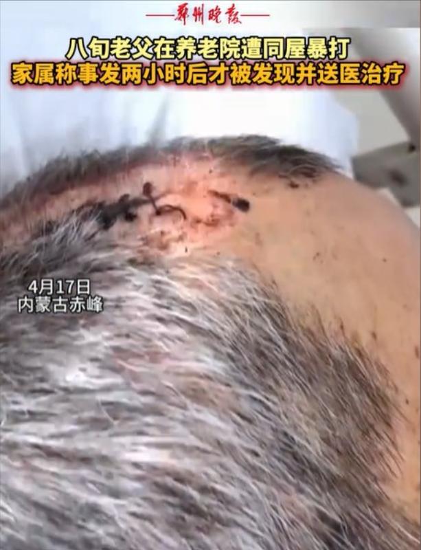 内蒙古赤峰，女子将丈夫送到养老院，几天后接丈夫，只见丈夫裤子直接裂开到裤裆，上衣