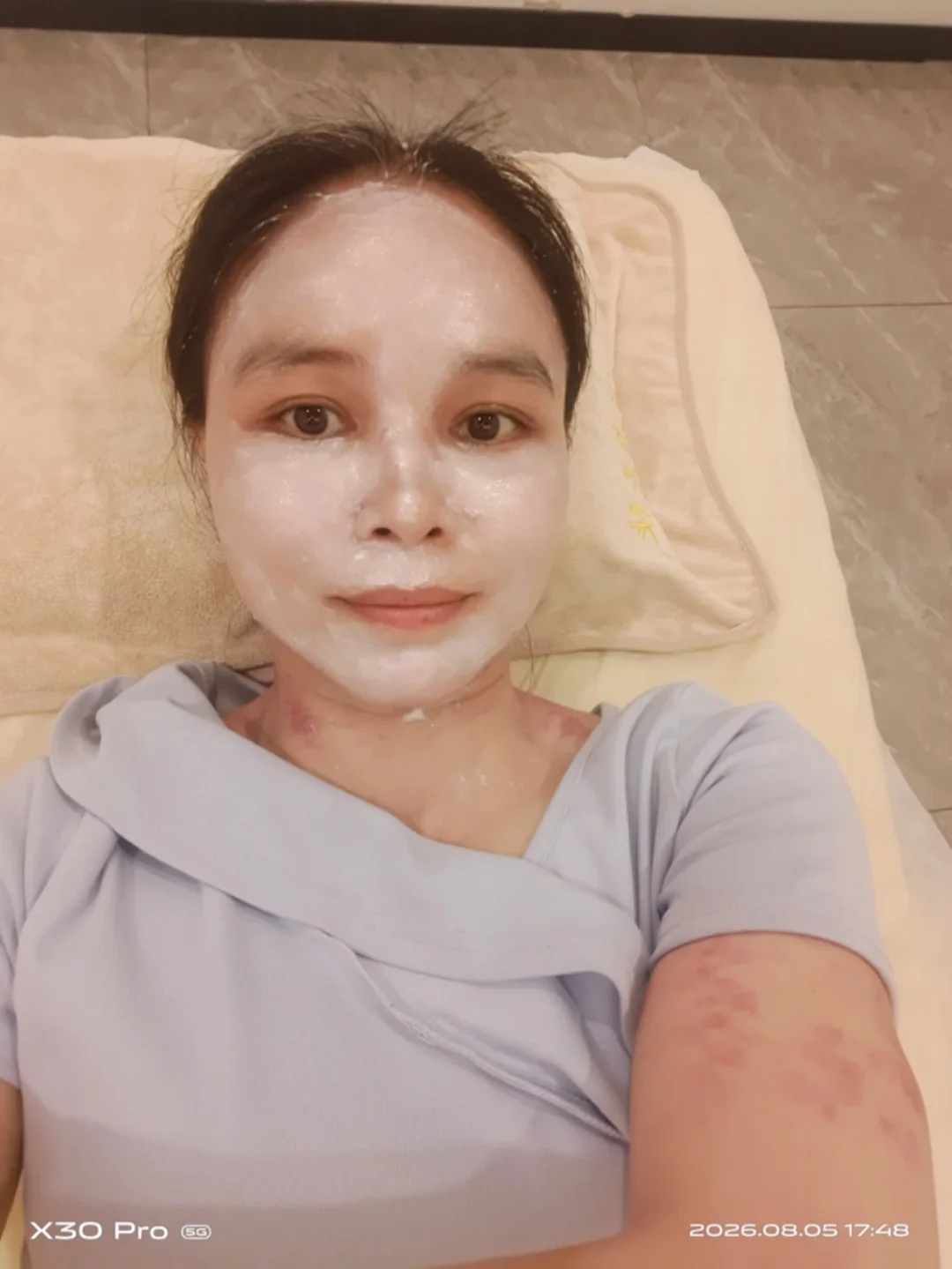 今天忙完在等下一个的时候，把自己脸部做了