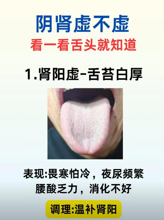 中医望舌自测：舌头这些表现，提示肾气亏虚