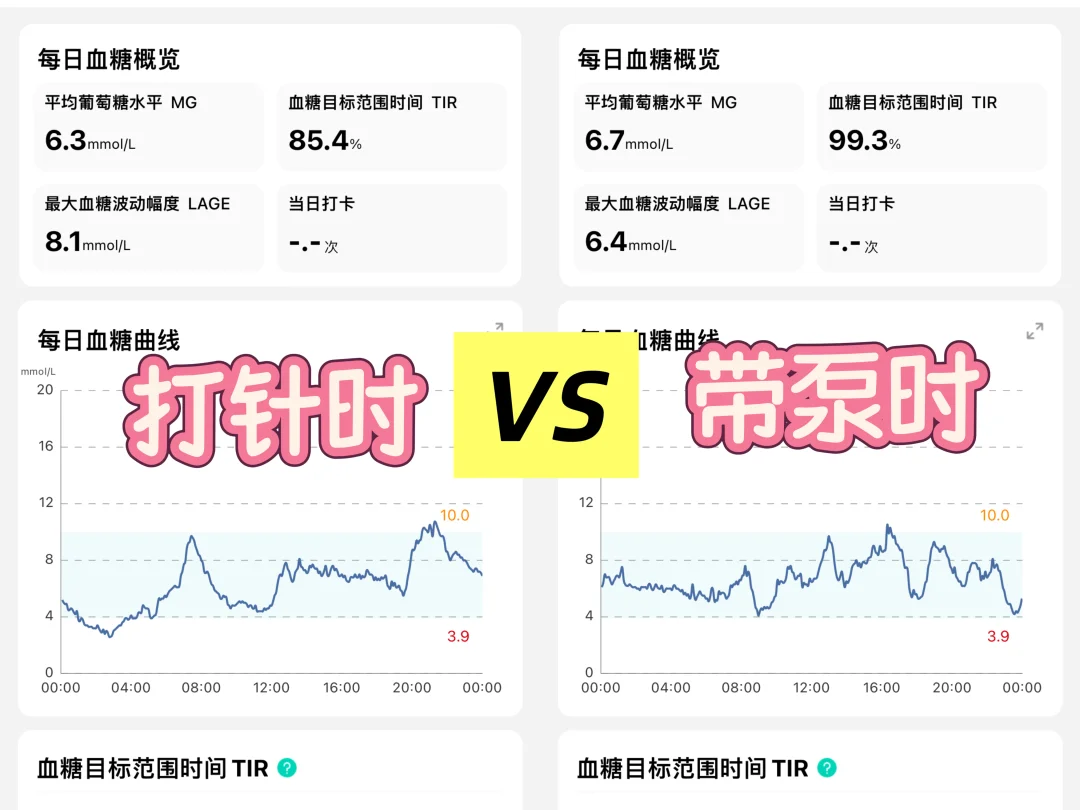 1型糖友针泵切换实录！
